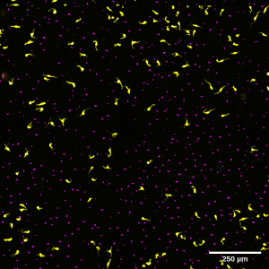Live image of EYFP/H2BCerulean labelled melanoblasts migrating on the dorsal lateral pathway. (Richard Mort)