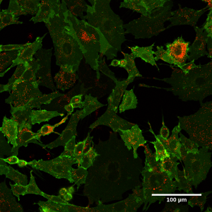 Live image of cKit-sfGFP/mCherry 'timer tag' labelled NIH 3T3 cells. (Olivia Harrison)